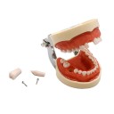 Utbildningstypodont med 32 tänder Mjuk avtagbar tandköttsdel Avtagbara anatomiska tänder + 32 reservdelar 4