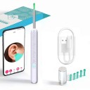 Limpiador de oídos visual con cámara NE3-D WiFi Endoscopio de oídos Full HD Luz LED Puntas de silicona Carga a través de USB-C 3