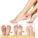 2 uds Spray exfoliante líquido para pies 200 ml Cuidado coreano 72h hidratación Ablandamiento de callos Sin alcohol Nebulización suave 5