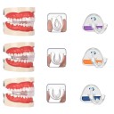 3 faze aparate dentare pentru adulți Corector ortodontic transparent 3 durități pentru corectarea dinților și îmbunătățirea zâmbetului 6