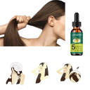 Aceite esencial de jengibre para el crecimiento del cabello 30 ml Anticaída del cabello Extracto de ginseng Nutrición de la piel Regeneración capilar Cabello más fuerte y grueso 3