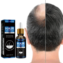 Aceite esencial de romero 30 ml Crecimiento del cabello Anticaída Reparación del cabello dañado Cuidado del jengibre Regeneración Adelgazamiento del cabello gris Hombres 2