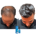 Aceite esencial para el crecimiento del cabello 30ml Tratamiento natural contra la caída del cabello Favorece la densidad Nutre las raíces del cabello 3