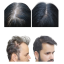 Ayurvedisches Haarwuchsöl 50 ml Indien Bio-Serum gegen Haarausfall Schnelles Wachstum Rosmarin Rizinus Olivenöl Zwiebelöl 2