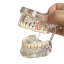 Az emberi fogak átlátszó modellje 2