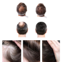 Biotin Serum Spray 30 ml Haarwachstum Vorbeugung von Haarausfall Kopfhauternährung Hydratation Bart Reparatur von geschädigtem Haar 2
