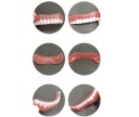 Conjunto de próteses dentárias de silicone Superior e inferior substituição de silicone Dentes temporários Aparência natural Aplicação fácil DIY 5