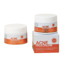 Crème Active contre l'Acné Régulation de la Graisse Réduction des Pores Réduction des Taches Régénération Crème Hydratante pour le Visage Soin 3