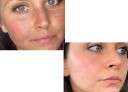 Crème pour le visage contre les taches pigmentaires 2