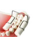 Dentálny držiak vatových valčekov 4 ks cca 2,1 x 2,6 cm nerezová oceľ ortodontické klipy pre fixáciu bavlnených rolí pri ošetrení 3