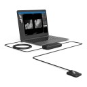 Digitaalinen intraoraalinen röntgenanturi R2 AI-analyysillä ja ohjelmistolla, USB-kaapeli 3 m, fotonilaskentateknologia, musta, hammaslääketieteeseen 4