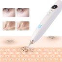 Dispositivo a laser para remoção de tatuagens 9 níveis 15x2x2 cm Verrugas Papilomas Sinais de Beleza Tecnologia de iões eletrónicos Carregamento USB 1200mAh 3