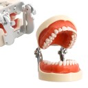 Educational Typodont of Dentition 32 Teeth Soft Removable Gum Part Removable Anatomical Teeth + 32 Replacement Pieces 2
