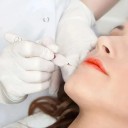 Electric Pen for Blackheads and Pigmentation Spots with Case 4 Heads 5 Speeds LCD Display 60 Hz 17 x 2.5 cm EU Plug 2