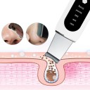 Espátula facial ultrasónica 3
