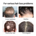 GINZO correttore per capelli per calvizie 40ml, correttore colorante per capelli per uomini e donne, resistente all'acqua, effetto duraturo 5-10 giorni 5