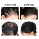 GINZO correttore per capelli per calvizie 40ml, correttore colorante per capelli per uomini e donne, resistente all'acqua, effetto duraturo 5-10 giorni 6