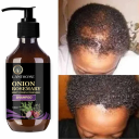 Haarwuchs-Shampoo 100 ml Rosmarin Zwiebel Minze Gegen Haarausfall Haarnahrung Glänzendes und weiches Haar Beschädigtes Haar Haarpflege 2
