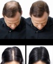 Keratinfibre til at gøre tyndt hår tykkere 2