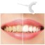 LED dentální nástroj na bělení zubů Přístroj na bělení zubů ve tvaru U pro čištění úst s LED světlem Domácí bělení zubů 3