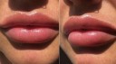 Lip Plumping Serum 2