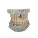 Modèle transparent de la dentition humaine 1