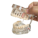 Modèle transparent de la dentition humaine 2
