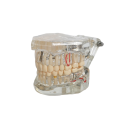 Modèle transparent de la dentition humaine 3