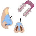 Modeleur de nez 4