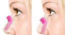 Næseolie 30 ml 3