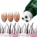 Nourishing Scalp Oil with Roller Head Care Support for Hair Growth Regeneration of Hair Roots Easy Application 2