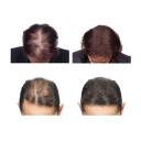 Olio per la crescita dei capelli 35 ml 3