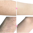 Ontharingspray 20 ml Snelle verwijdering van haartjes voor mannen en vrouwen Pijnloze ontharing van het lichaam Eenvoudige applicatie binnen enkele 2