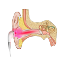 Oordopjes met 650nm LLLT lasertherapie tegen tinnitus USB voeding Laagfrequent rood licht Regeneratie en ontspanning van de oren 3