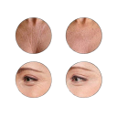 Patches contro le rughe 11 pz 3