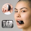 Placa de fósforo para raios X dentários sem íman, tamanho 2 (31 × 41 mm), sensor PSP digital, preto, para RX intraoral com scanner 5