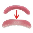 Plaques de fixation pour prothèses dentaires 2 pcs Fixation stable Confort de port Meilleure adhérence Contre l'irritation Utilisation facile Soins dentaires 3