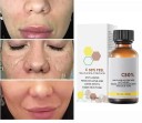 Pleťové sérum Chemický peeling 50% Jablková a citrónová kyselina Sjednocuje tón pleti Redukuje pigmentové škvrny Anti-aging 30 ml 2