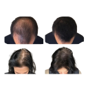 Poudre capillaire universelle pour femmes et hommes Fibres capillaires Correcteur pour couvrir les zones dégarnies Épaississement des cheveux Effet naturel de coiffure 2