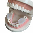 Protector contra el rechinamiento de dientes 2