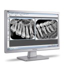 Radiografía dental digital portátil manual 70 kV / 2 mA, foco 0,4 mm, 1,7 kg, de alta frecuencia, blanca, para odontología humana y veterinaria 4