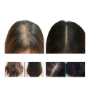 Rosemary Hair Oil with Roller Nourishing Moisturising Serum Against Hair Loss Strengthening Regenerative Hair Care 3