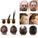 Ser pentru cresterea sprancenelor, barba si parului 5 ml Activarea foliculilor de par Par mai gros si mai puternic Compozitie naturala Hranire 3
