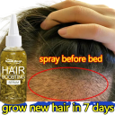 Serum cu ulei pentru păr 60 ml Serum esențial împotriva căderii, ulei hrănitor și hidratant pentru toate tipurile de păr 5