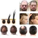 Sérum pour la croissance des sourcils, de la barbe et des cheveux 5 ml Activation des follicules pileux Des poils plus denses et plus forts 3