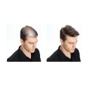 Siero per la crescita dei capelli 30 ml 3