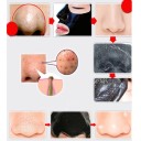 Sort Peel-Off Maske mod hudorme 5