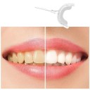 Strumento dentale LED per sbiancamento dentale Dispositivo per sbiancamento dentale a forma di U per la pulizia orale con luce LED Sbiancamento dentale domestico 3