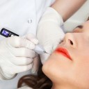 Stylo plasma laser 2