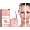 Suero facial de niacinamida (30 ml), corrector de manchas de pigmentación, hidratación, aclara los poros, cuidado de la piel con vitamina B3. 2